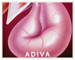 Slider image (8) Adiva | Super Speciality Care